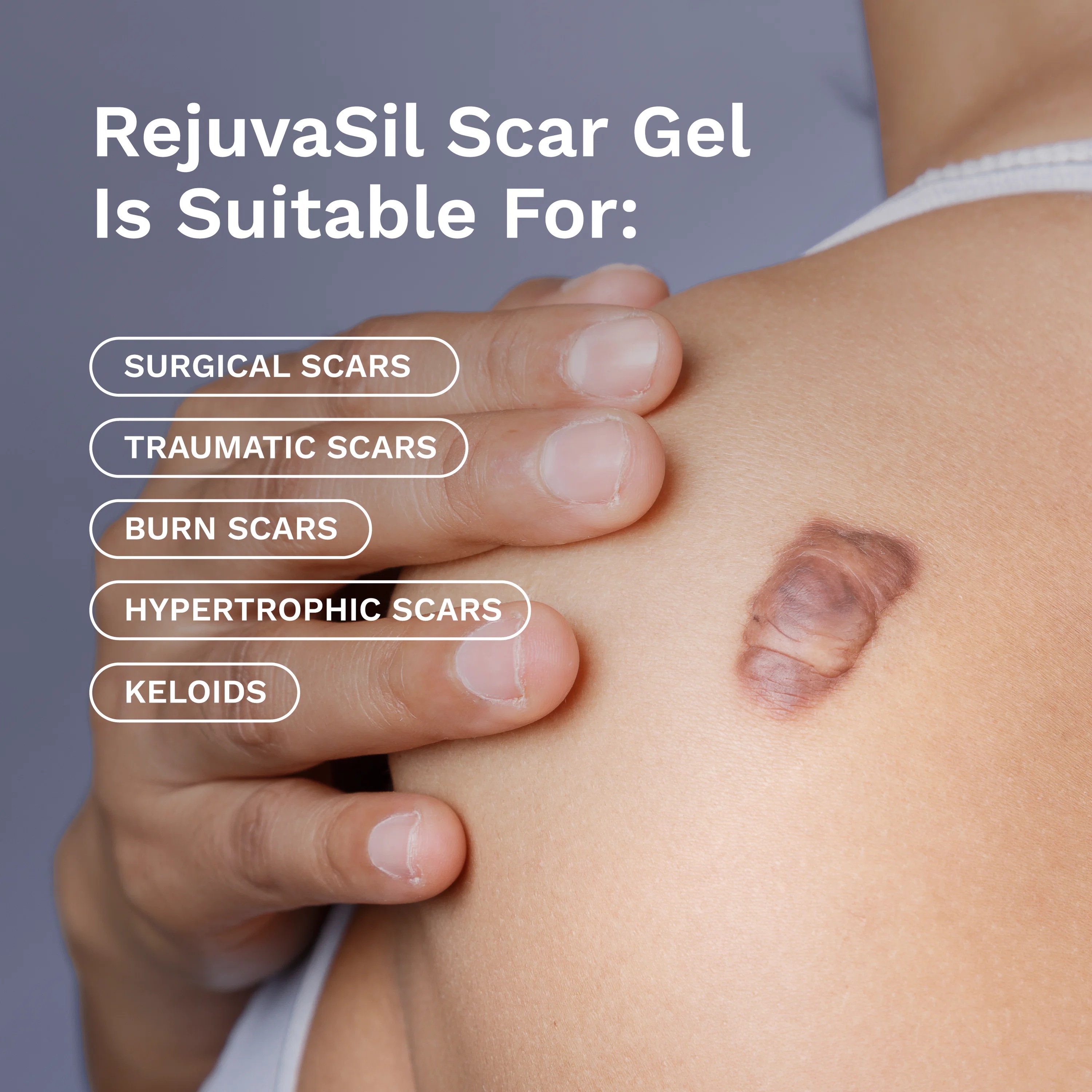 RejuvaSil® Silicone Scar Gel, Unscented, 0.338–1 fl oz (10–30 mL) – Select Size